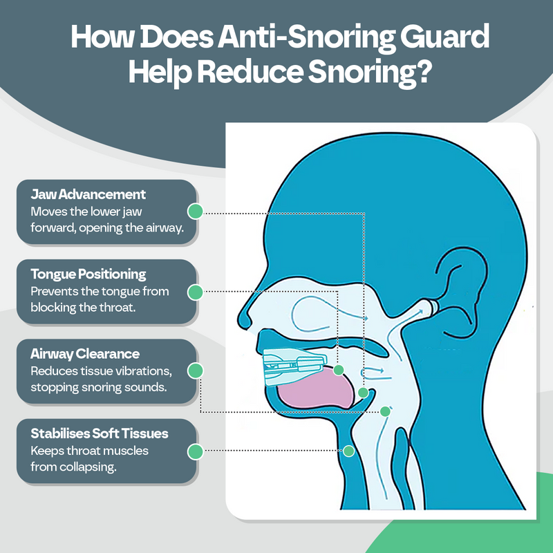 Anti Snoring Mouth Guard